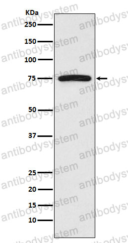 Anti-FRS2 Antibody (R2J28)