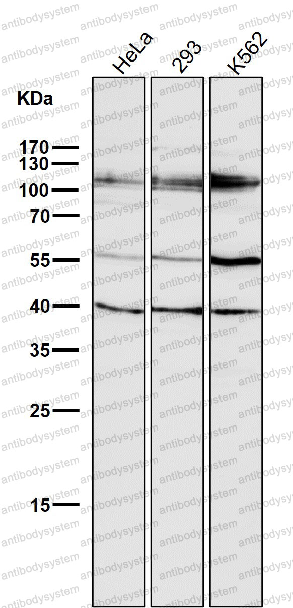 Anti-HDAC7 Antibody (R2J30)
