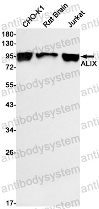 Anti-PDCD6IP/ALIX Antibody (R2J33)