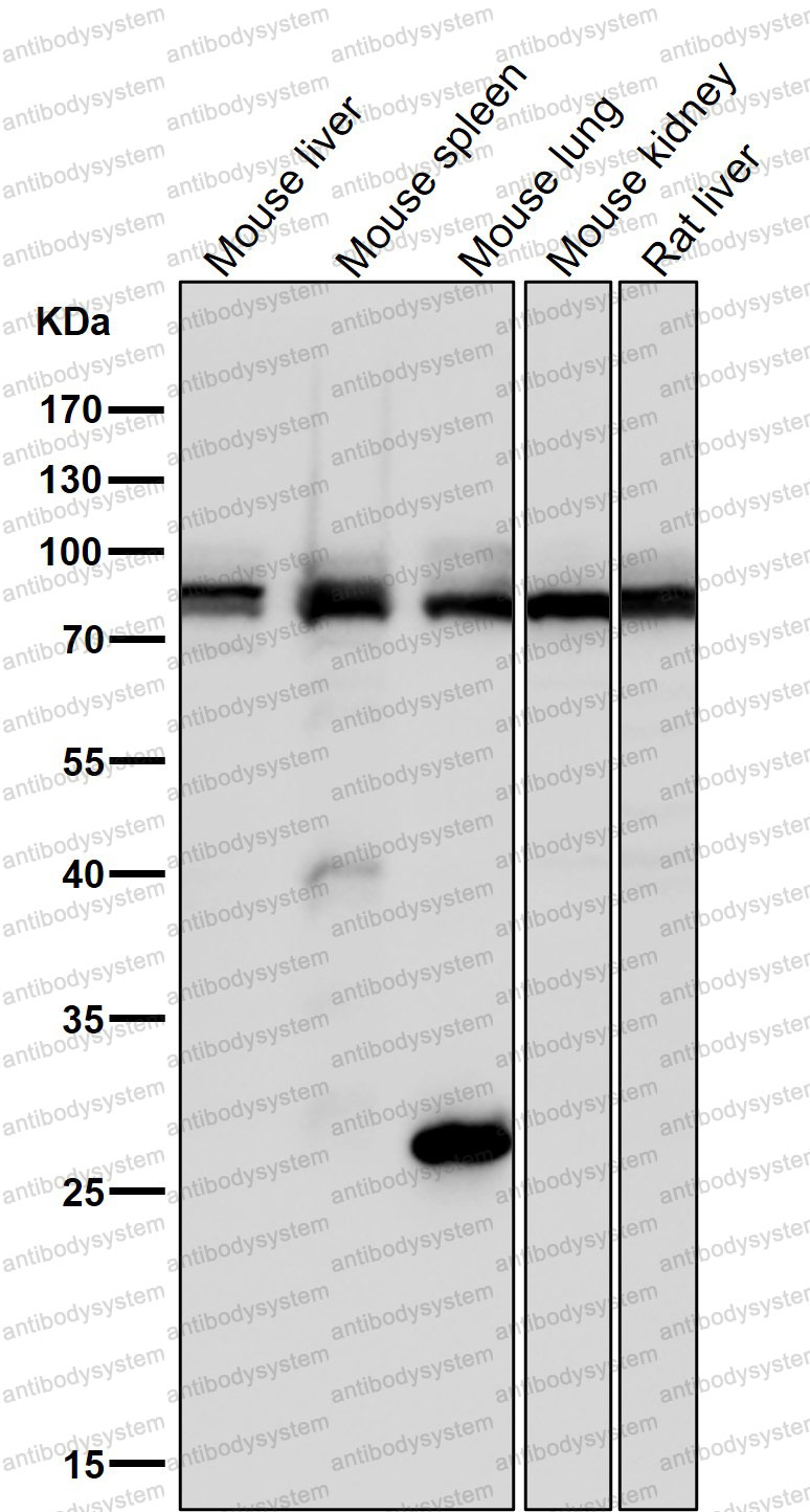 Anti-PDCD6IP Antibody (R2J31)