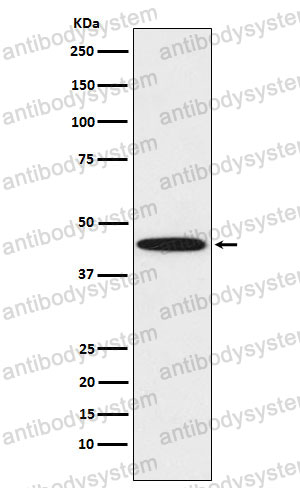 Anti-DDB2 Antibody (R2J35)