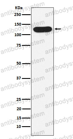Anti-NCSTN Antibody (R2J36)