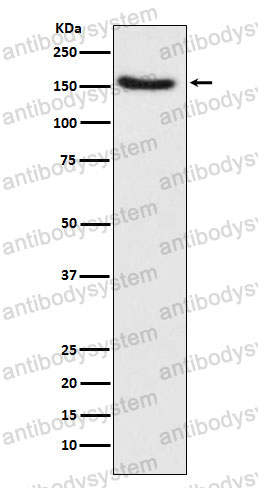 Anti-TSC1 Antibody (R2J38)