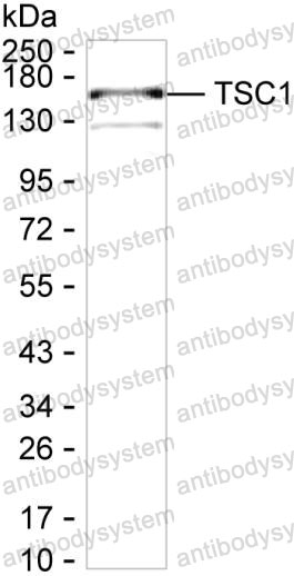 Western blot for Anti-TSC1 Antibody (R3V56) ?>
