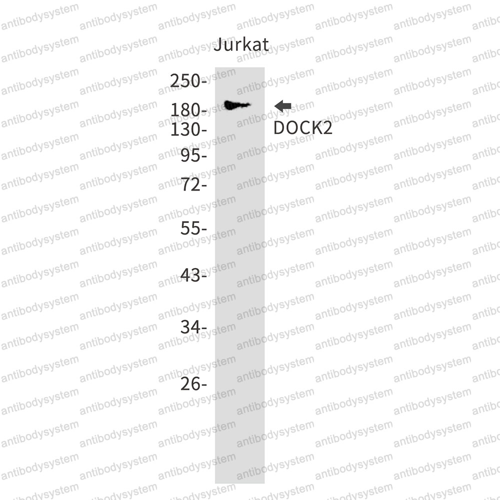 Anti-DOCK2 Antibody (R2J40)