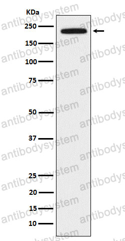 Anti-DOCK2 Antibody (R2J39)