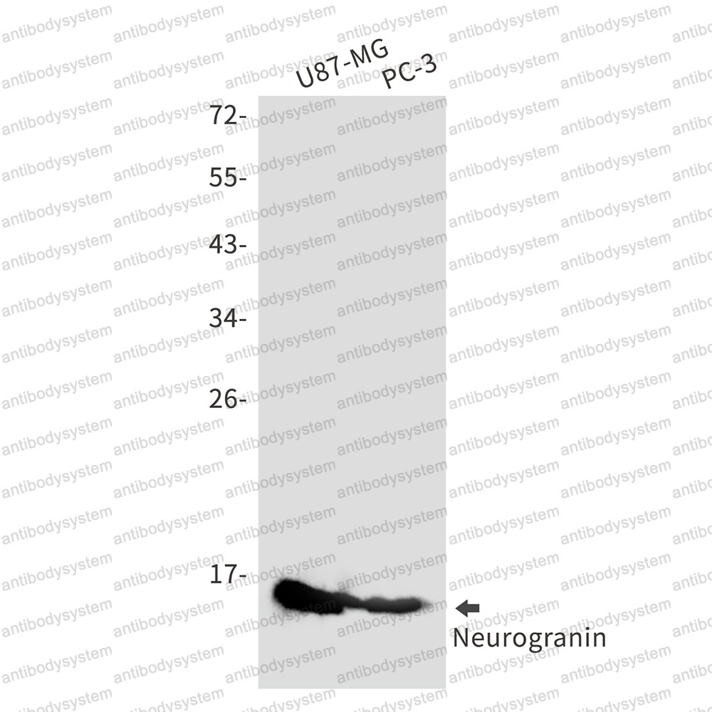 Anti-NRGN Antibody (R2J41)