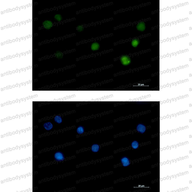 Anti-ANP32B Antibody (R2J43)