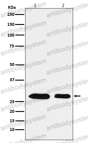 Anti-ANP32B/APRIL Antibody (R2J42)