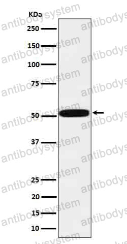 Anti-HTRA1 Antibody (R2J46)
