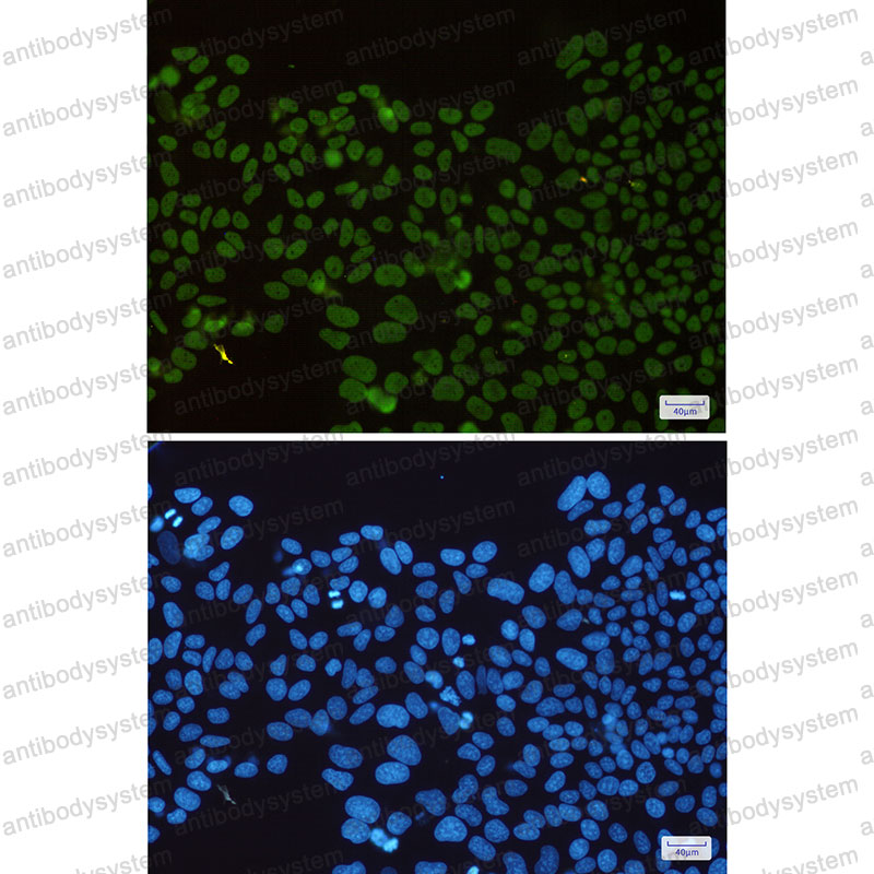 Anti-HDAC2 Antibody (R2J47)