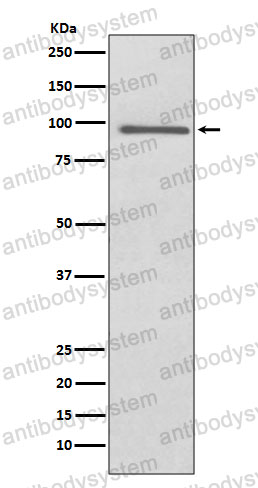 Anti-PROX1 Antibody (R2J48)