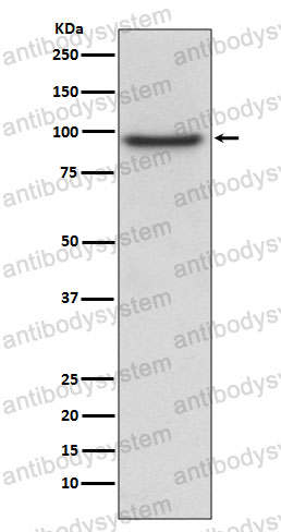 Anti-PROX1 Antibody (R2J49)
