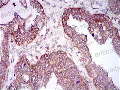 Immunohistochemical for Anti-HAS2 Antibody (R3V61) ?>