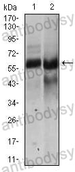 Western blot for Anti-HAS2 Antibody (R3V61) ?>
