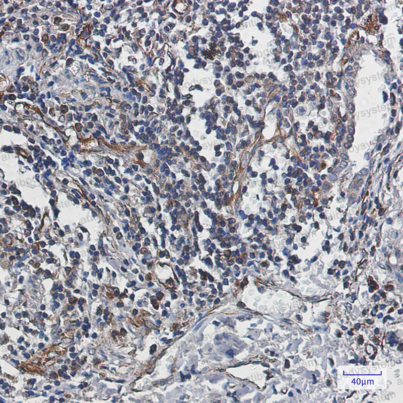 Anti-CASP10 Antibody (R2J53)