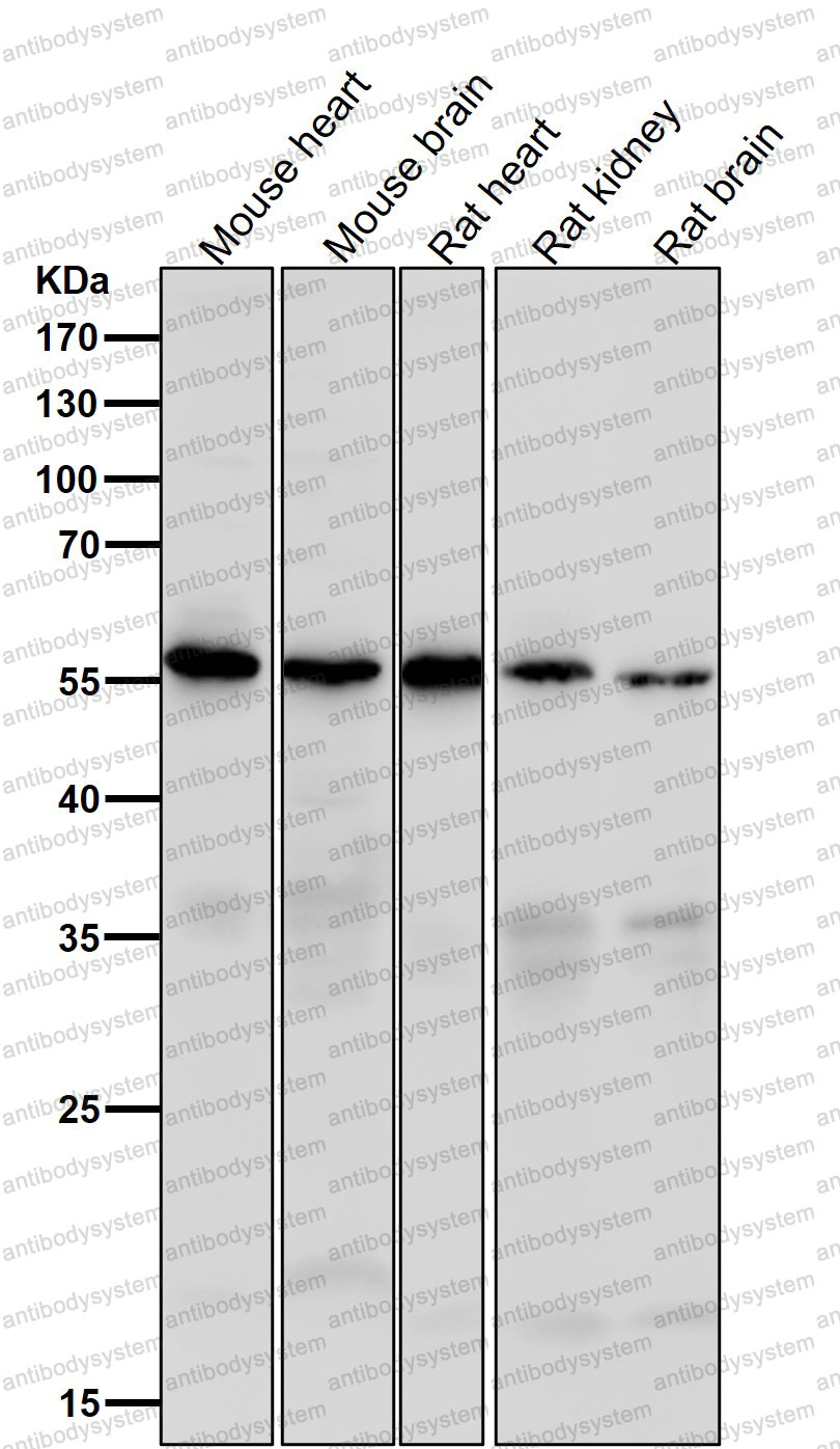 Anti-CASP10 Antibody (R2J52)