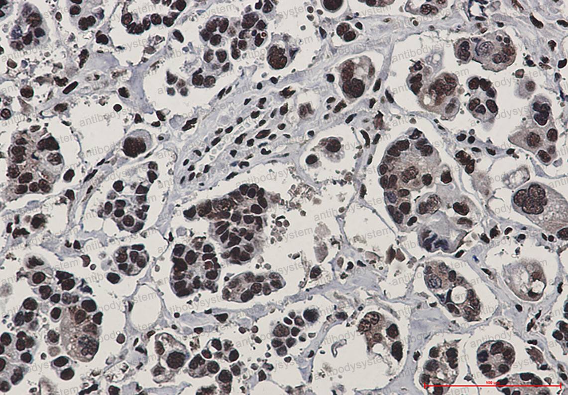 Anti-RAD50 Antibody (R2J55)