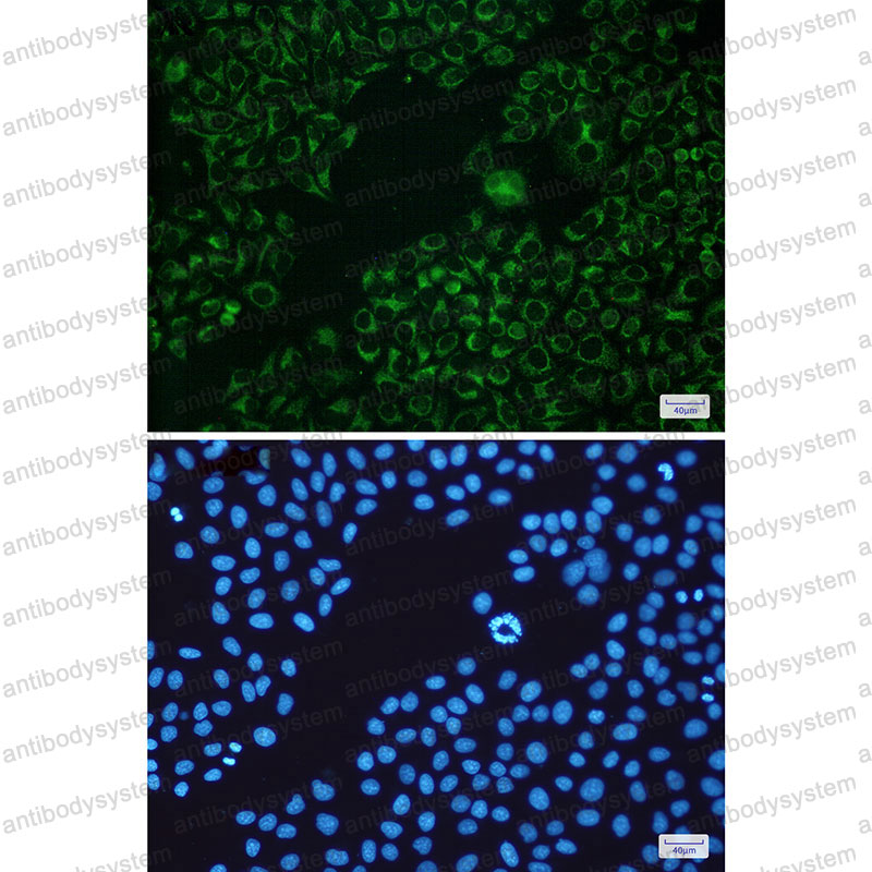 Anti-BAD Antibody (R2J57)