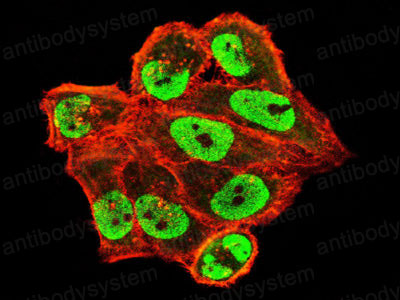 Immunofluorescence for Anti-USP7 Antibody (R3V69) ?>