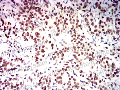 Immunohistochemical for Anti-USP7 Antibody (R3V69) ?>
