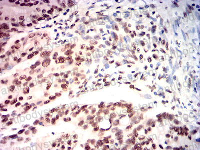 Immunohistochemical for Anti-USP7 Antibody (R3V69) ?>