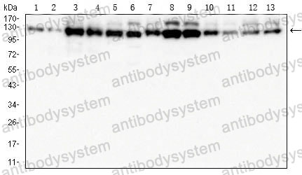 Western blot for Anti-USP7 Antibody (R3V69) ?>