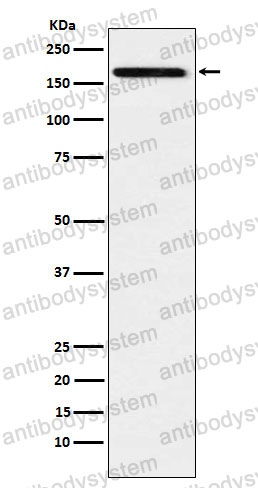 Anti-CD217/IL17RA Antibody (R2J69)