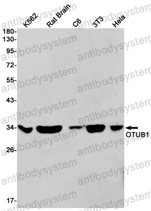 Anti-OTUB1 Antibody (R2J70)