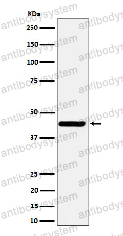 Anti-NODAL Antibody (R2J74)