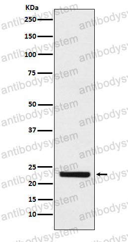 Anti-HBEGF Antibody (R2J76)