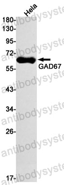 Anti-GAD1/GAD67 Antibody (R2J79)