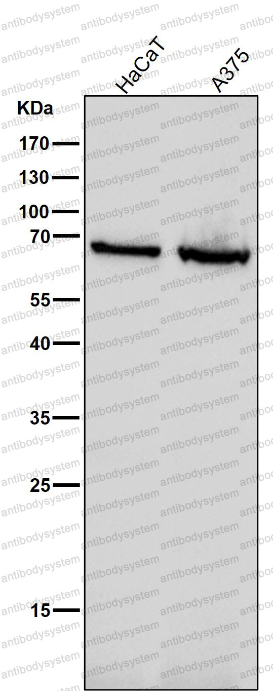 Anti-GAD1/GAD67 Antibody (R2J78)