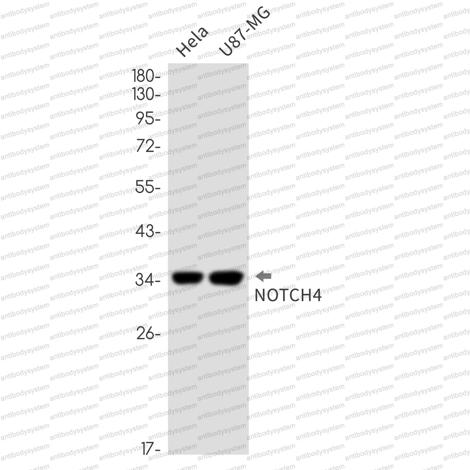 Anti-NOTCH4 Antibody (R2J80)