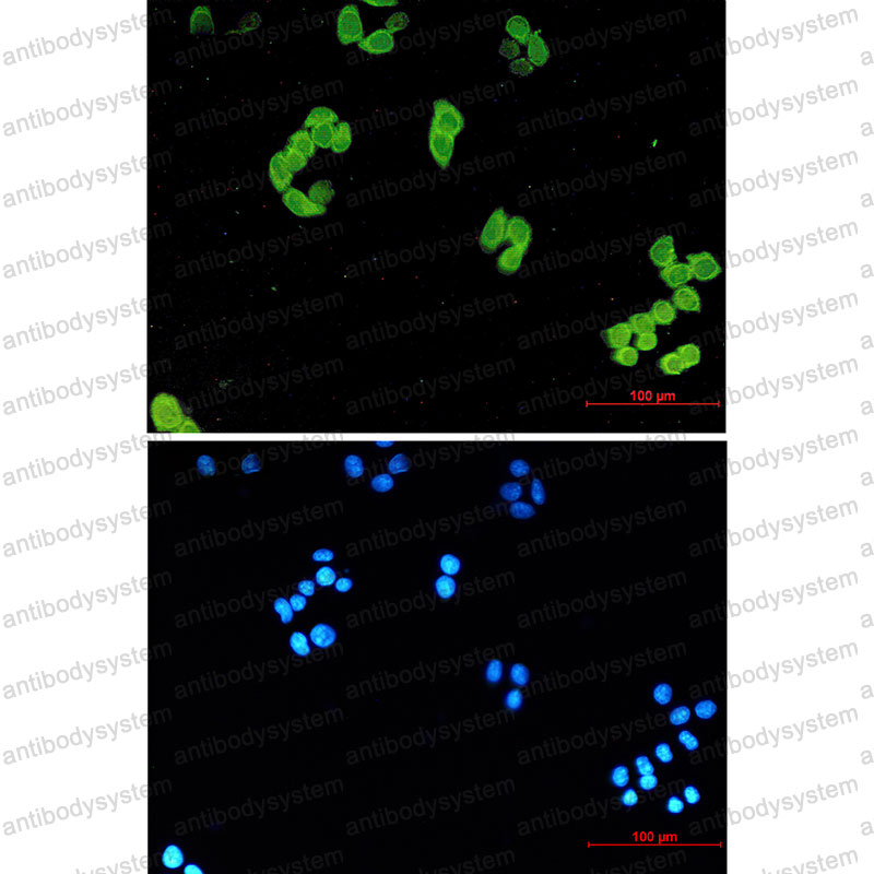 Anti-PARK7/DJ1 Antibody (R2J81)