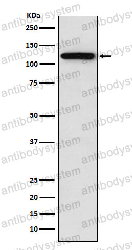 Anti-SORT1/Gp95/Sortilin Antibody (R2J82)