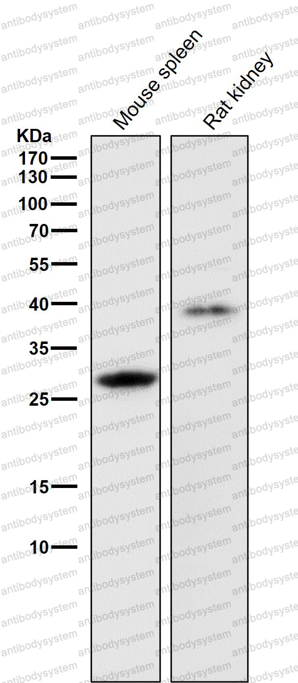Anti-LGMN/Legumain Antibody (R2J84)