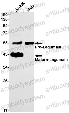 Anti-LGMN/Legumain Antibody (R2J85)
