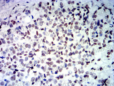 Immunohistochemical for Anti-CDX2 Antibody (R3W02) ?>