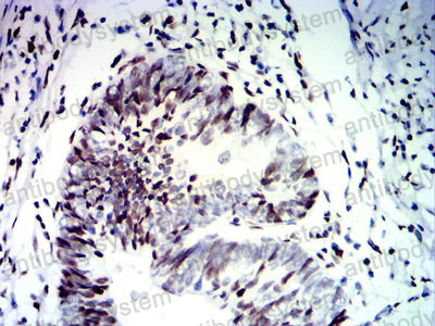Immunohistochemical for Anti-CDX2 Antibody (R3W02) ?>