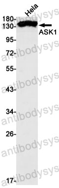 Anti-MAP3K5 Antibody (R2J86)