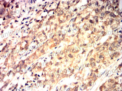 Immunohistochemical for Anti-TSG101 Antibody (R3W11) ?>