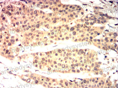 Immunohistochemical for Anti-TSG101 Antibody (R3W11) ?>