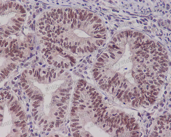 Anti-PYGO2 Antibody (R1A37)
