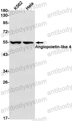 Anti-ANGPTL4 Antibody (R2K08)