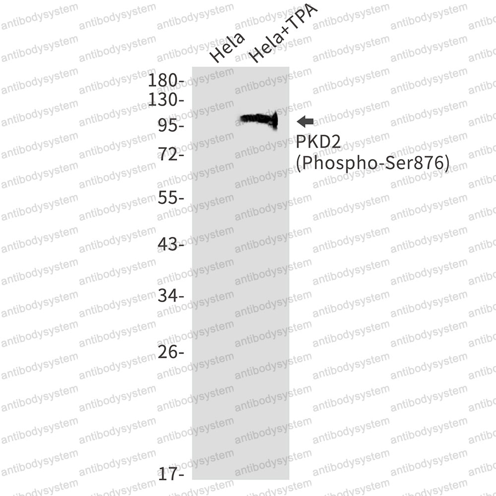 Anti-Phospho-PRKD2 (Ser876) Antibody (R2K14)