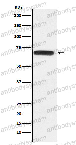 Anti-RACGAP1 Antibody (R2K15)