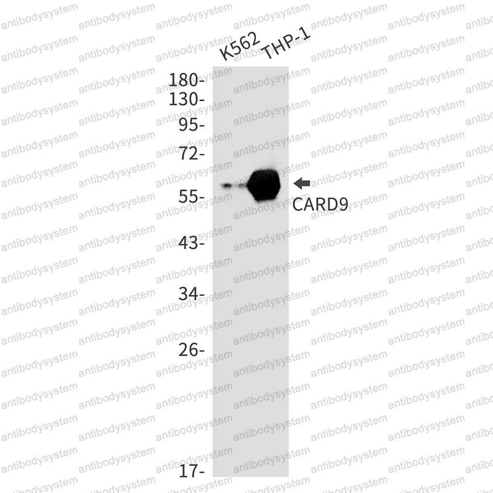 Anti-CARD9 Antibody (R2K17)