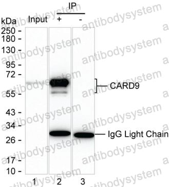Immunoprecipitation for Anti-CARD9 Antibody (R3W40) ?>