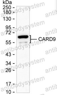 Western blot for Anti-CARD9 Antibody (R3W40) ?>
